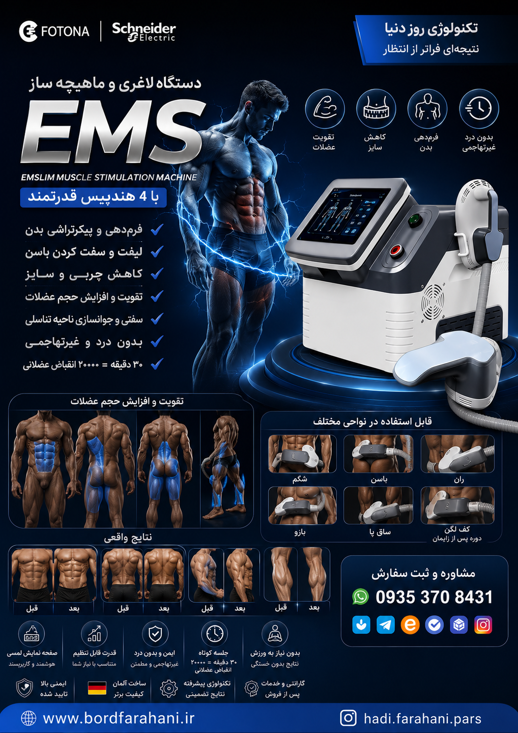 دستگاه لاغری و عضله سازی EMS